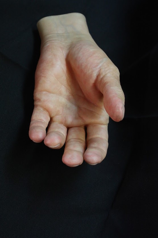 durable thumb prosthetics