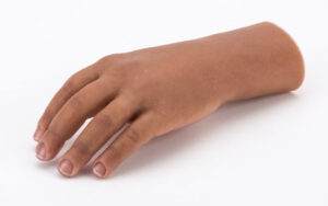What Custom Partial Hand Prosthetics Services Are Offered in Aurora, CO to Help Restore Hand Function?