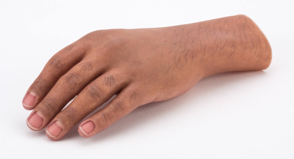 partial hand prosthetics