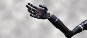 How do amputees hand prosthetics improve daily life in Raleigh, NC?