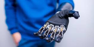 Evolution of Advanced Prosthetic Arms