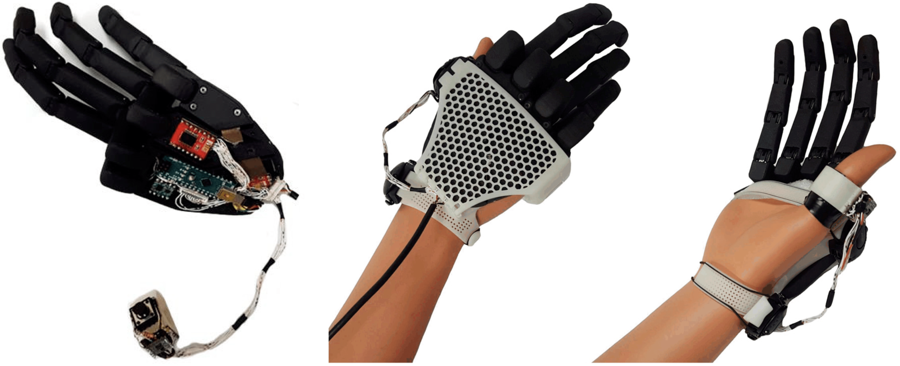Finger Prosthetics