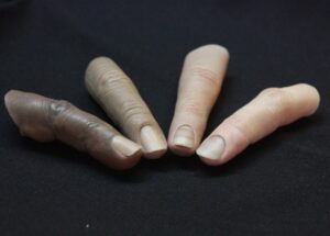 Will My Finger Prosthetics Be Custom-Made to Match My Skin Tone in Tulsa, OK?