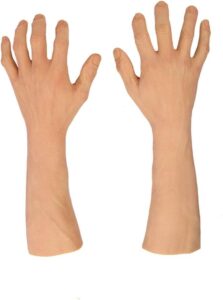 What is a Personalised Prosthetic Hand, and Where Can Patients Get One in Dallas?