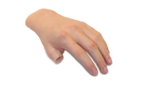 How Durable Are Thumb Prosthetics in Grand Rapids, MI?