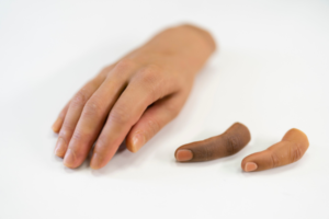Are affordable hand prosthetics available in Indianapolis, IN?