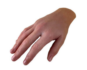 How Do Amputees Hand Prosthetics Options in Columbia, SC Compare in Terms of Functionality and Comfort?