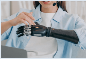 Partial Hand Prosthesis in Houston, TX: Restoring Function After Hand Amputation
