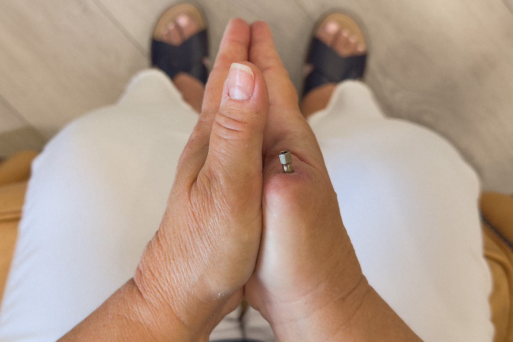 custom thumb prosthetics