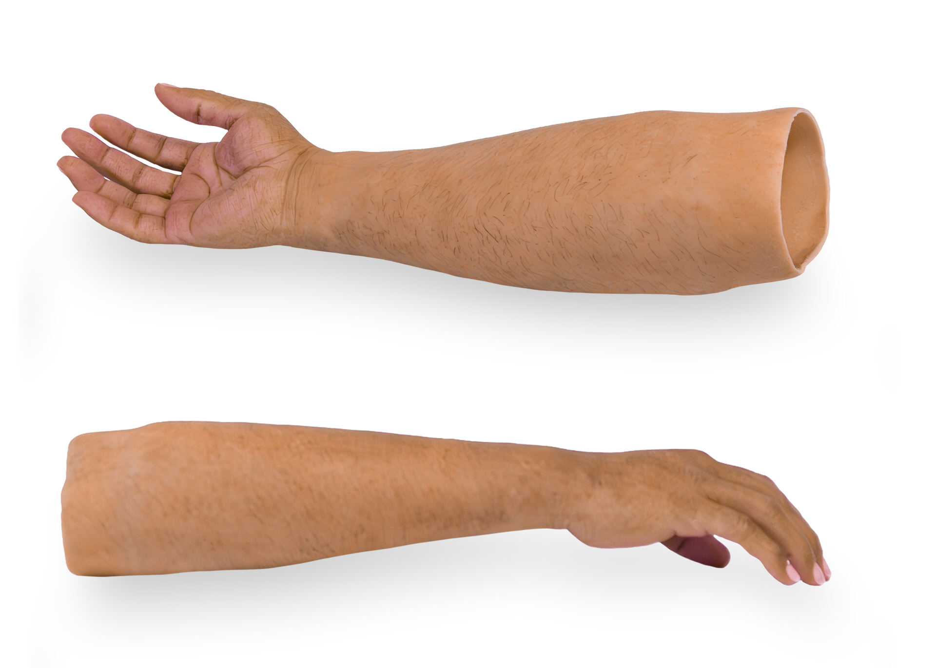 partial arm prosthetics rehabilitation