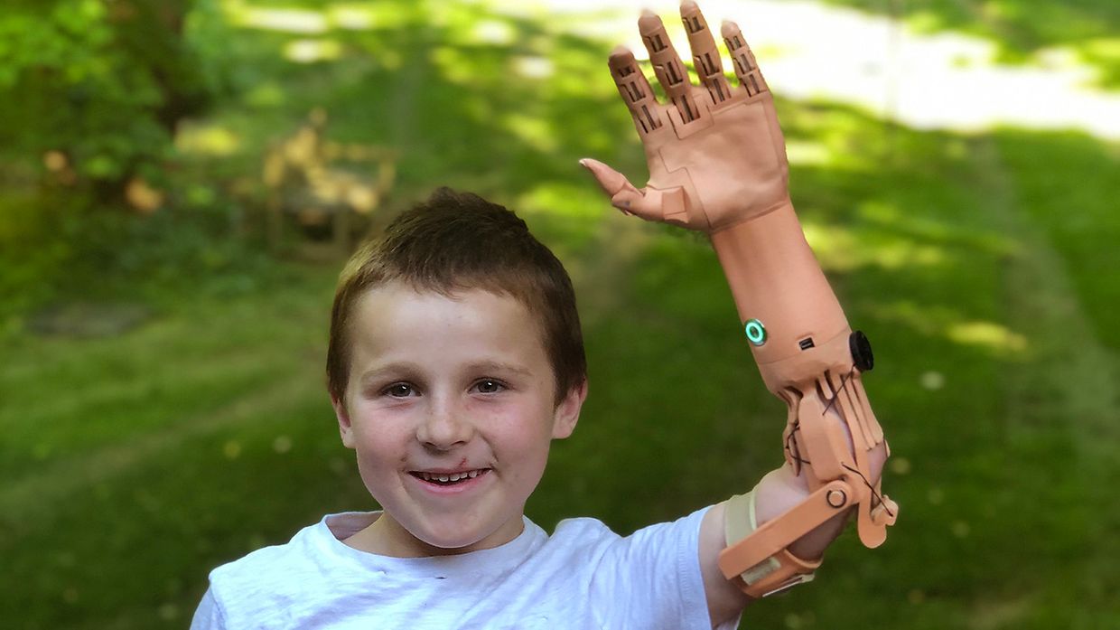Hand Prosthetics for Amputees