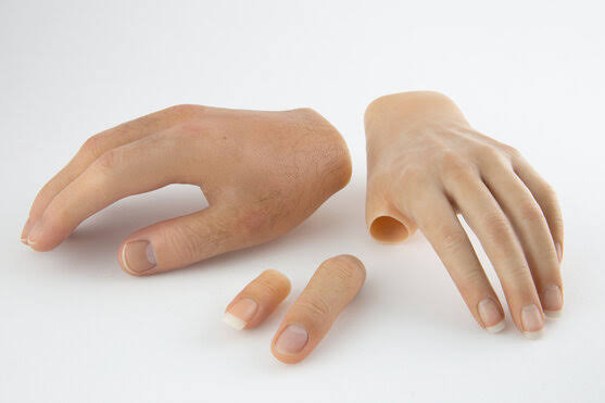 custom finger prosthetic