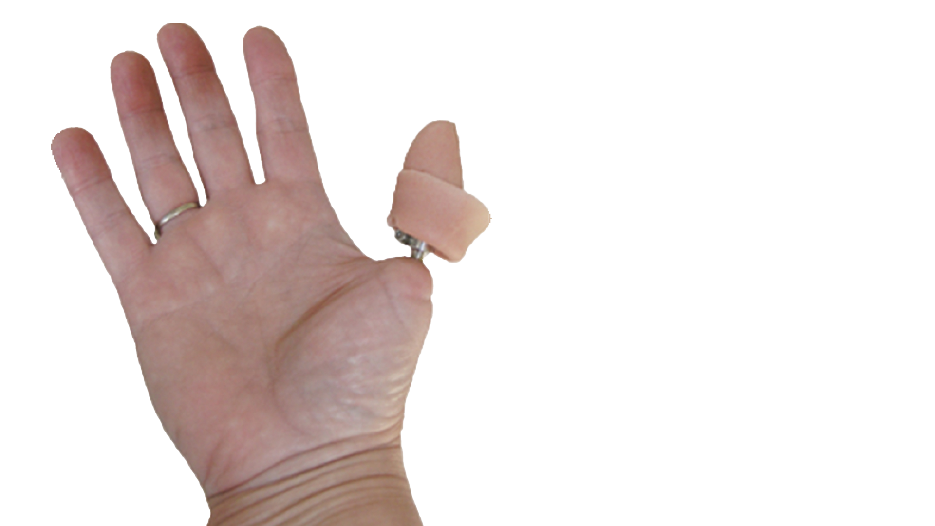 Robotic Thumb Prosthesis